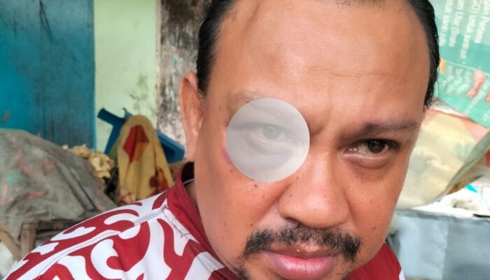 PIJIP Kecam Kinerja Polres Pamekasan, Laporan Penganiayaan Wartawan Memorandum Tak Kunjung Jelas
