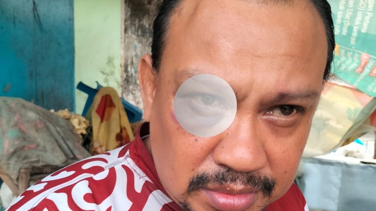 PIJIP Kecam Kinerja Polres Pamekasan, Laporan Penganiayaan Wartawan Memorandum Tak Kunjung Jelas