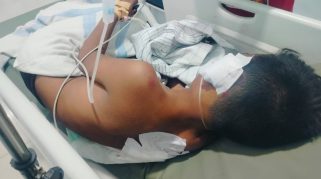 Seorang Anak di Blitar Jadi Korban ODGJ